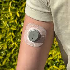 CGM sensor applied to upper arm
